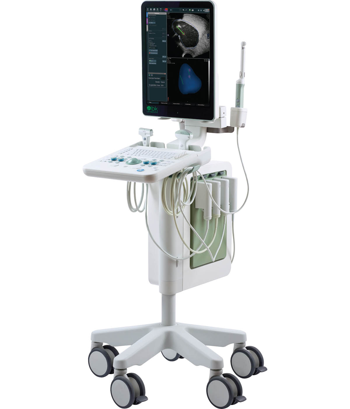 ultrasound rental